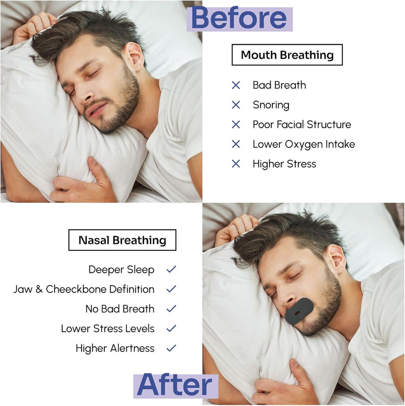 fmula+ Sleep Tape 30 Strips - Mouth Tape for Sleeping, Snoring Aid Mouth Tape for Men and Women, Helps Stop Snoring and Supports Nasal Breathing, Black fmula+